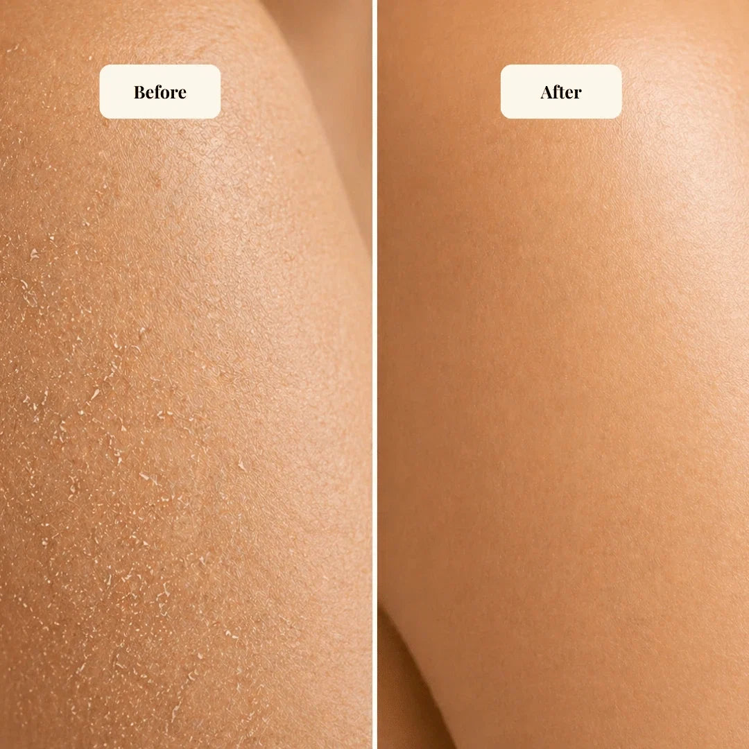Nourishing Body Butter Sensitive Skin Deep Hydration Moisturizer