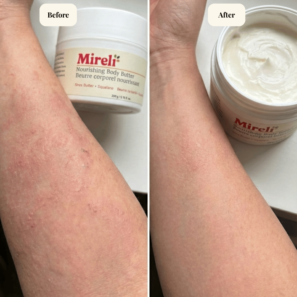 Nourishing Body Butter Sensitive Skin Deep Hydration Moisturizer
