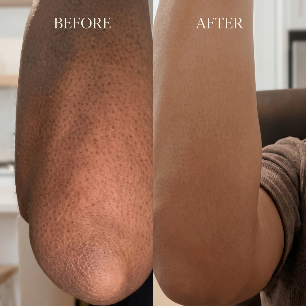 Nourishing Body Butter Sensitive Skin Deep Hydration Moisturizer